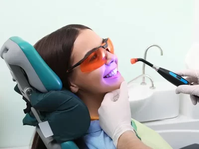 Dental Bonding Pros and Cons: All You Need to Know