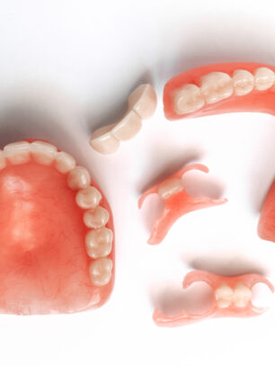 Types-of-Denture-Repairs-When-Same-day-Repair-is-Appropriate