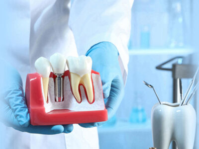 Pre- and Post-Op Care: Tips for a Successful Dental Implant Procedure