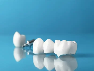 Why Choose Dental Crowns in Oak Lawn for Tooth Restoration
